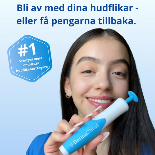 DermaTag™ - Smärtfri borttagning av hudflikar