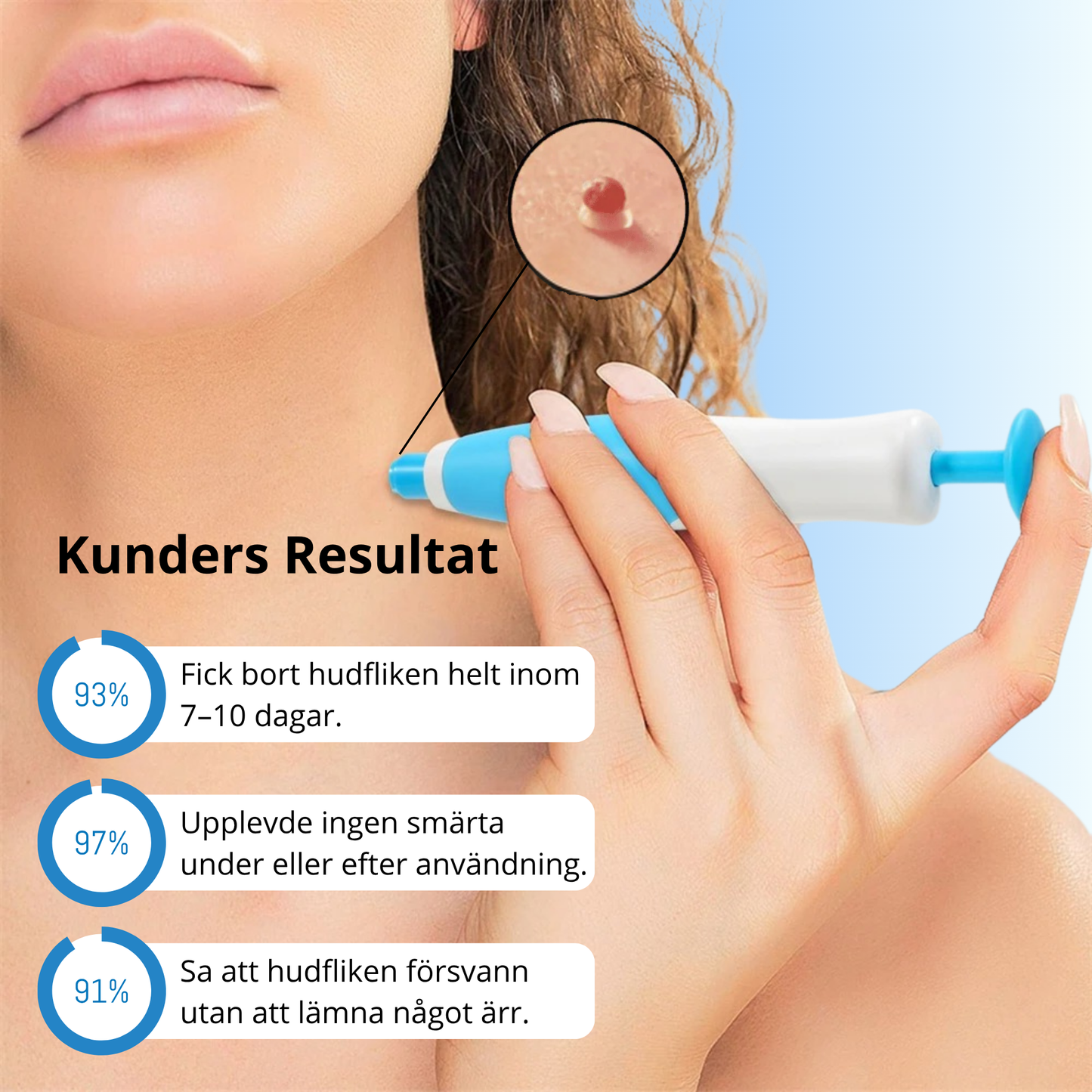 DermaTag™ - Smärtfri borttagning av hudflikar